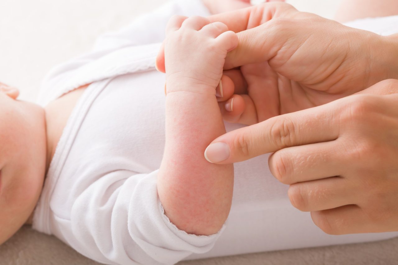 Bébé a de l'eczéma sur le bras